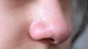 ব্ল্যাকহেডস দূর করার জন্য ওটসের তৈরি ২টি কার্যকরী ফেস স্ক্রাবার