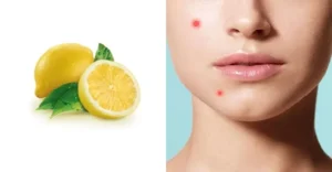 সাধ করে ত্বকের বারোটা বাজাচ্ছেন না তো? ঘরোয়া টোটকায় মারাত্মক বিপদের সংকেত!